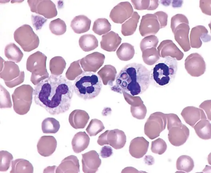 1664359390554980.png 骨髓涂片.png